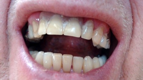 Dental Malpractice Attorney U.: Experts