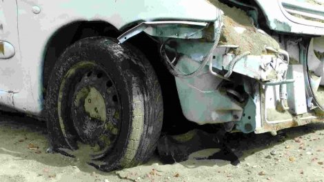 FAQ – What If You Committed Negligence Too?